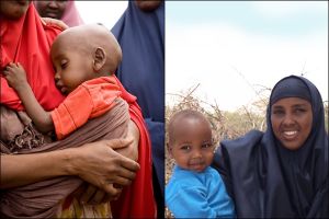 Niño somalí desnutrido recupera su salud