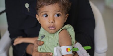 Niño en Yemen al que le miden el brazo para evaluar su grado de desnutrición