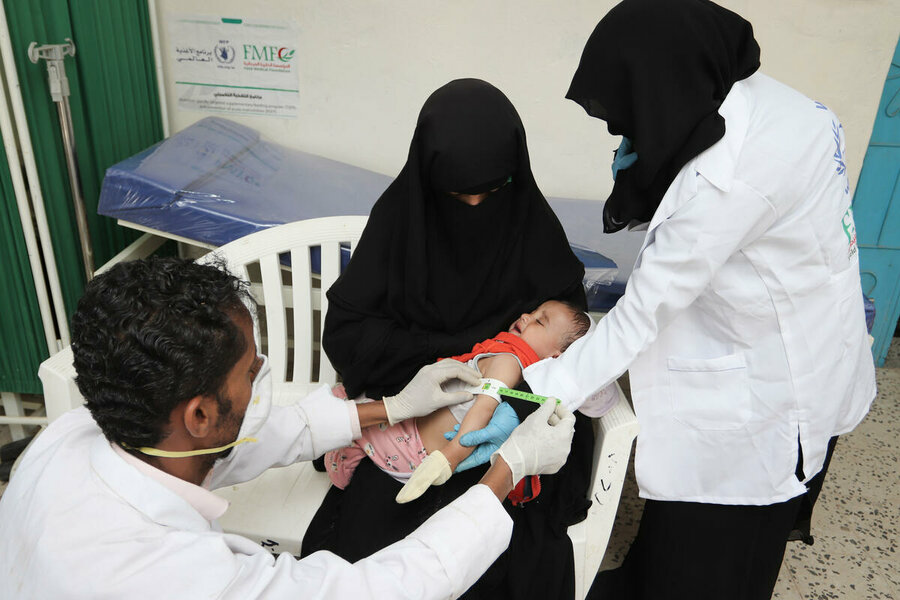 staff visiting malnourished child in Yemen