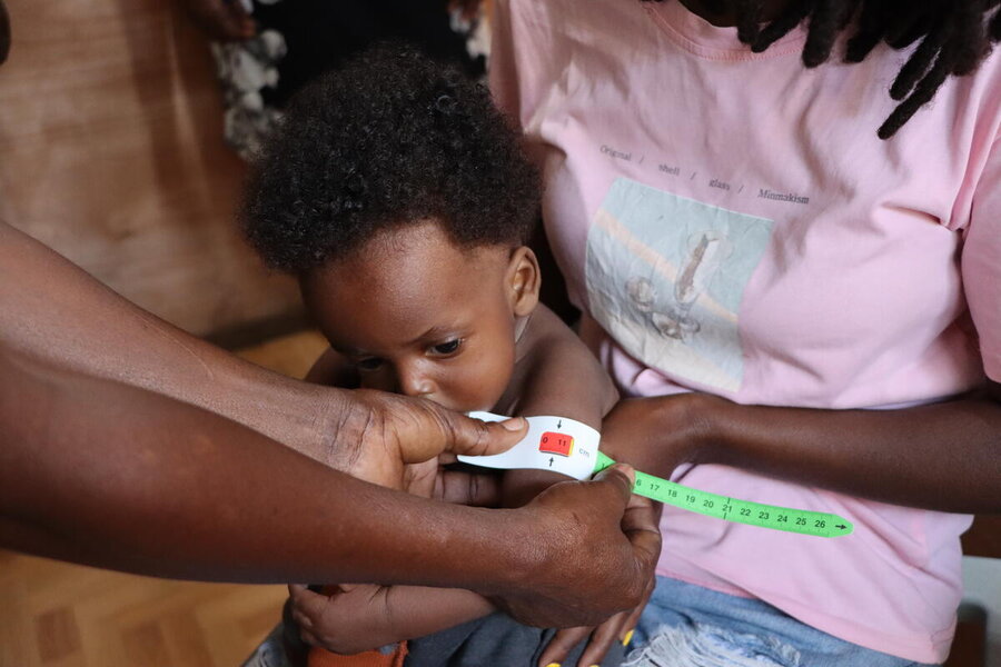 This infant shows signs of severe acute malnutrition during testing in Haiti. Photo: WFP/Alexis Masciarelli 