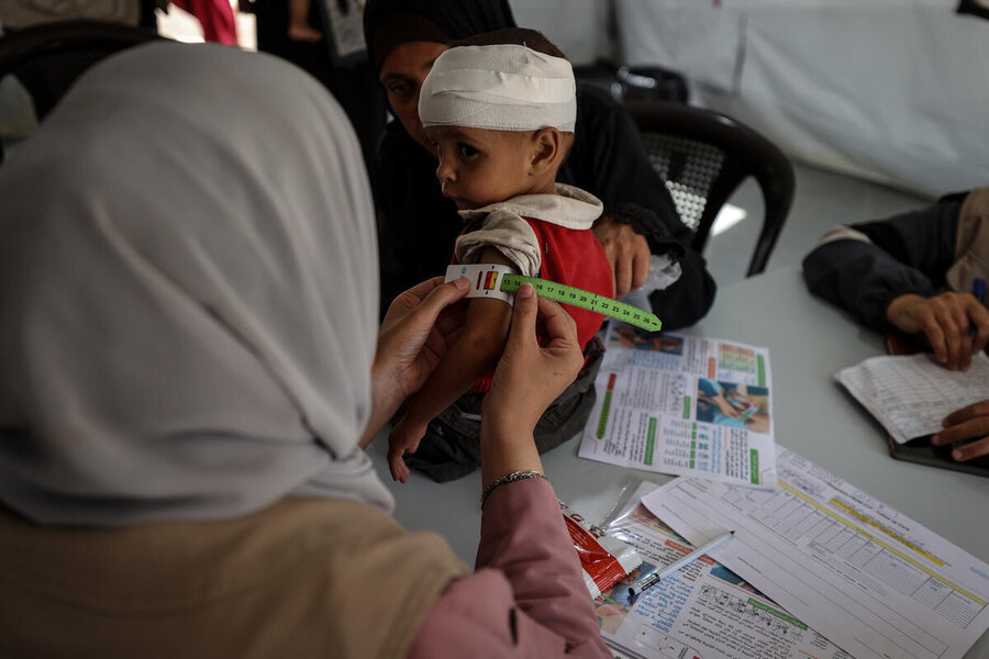 A child aged under 5 wearing a bandage on their head undergoes a nutrition assessment in Gaza