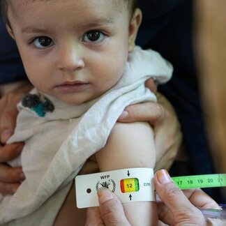 Una persona midiendo la circunferencia del brazo de un niño con una cinta métrica.