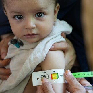 Niño con la cinta de circunferencia media del brazo (MUAC).